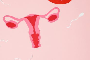 Simptomi endometrioze- kako ih smanjiti?